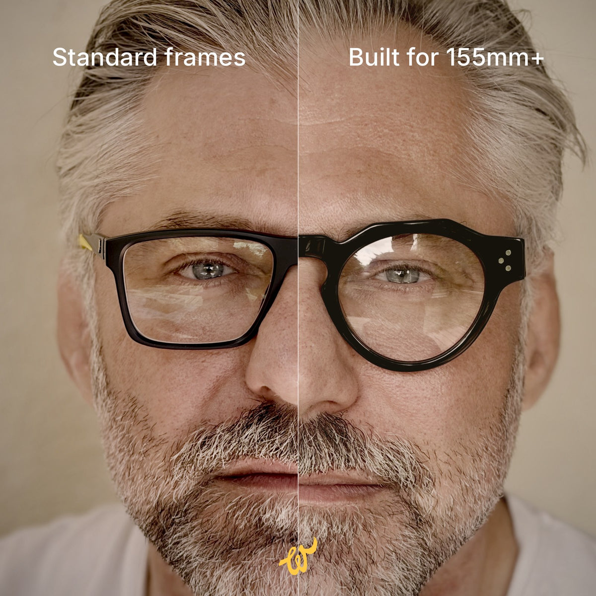 The same man in two frames: on the left a standard front that stops short of his temples, on the right a Woolet front built for faces 155 mm and wider